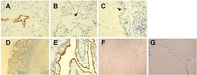 The Adrenal Cortex, an Underestimated Site of SARS-CoV-2 Infection